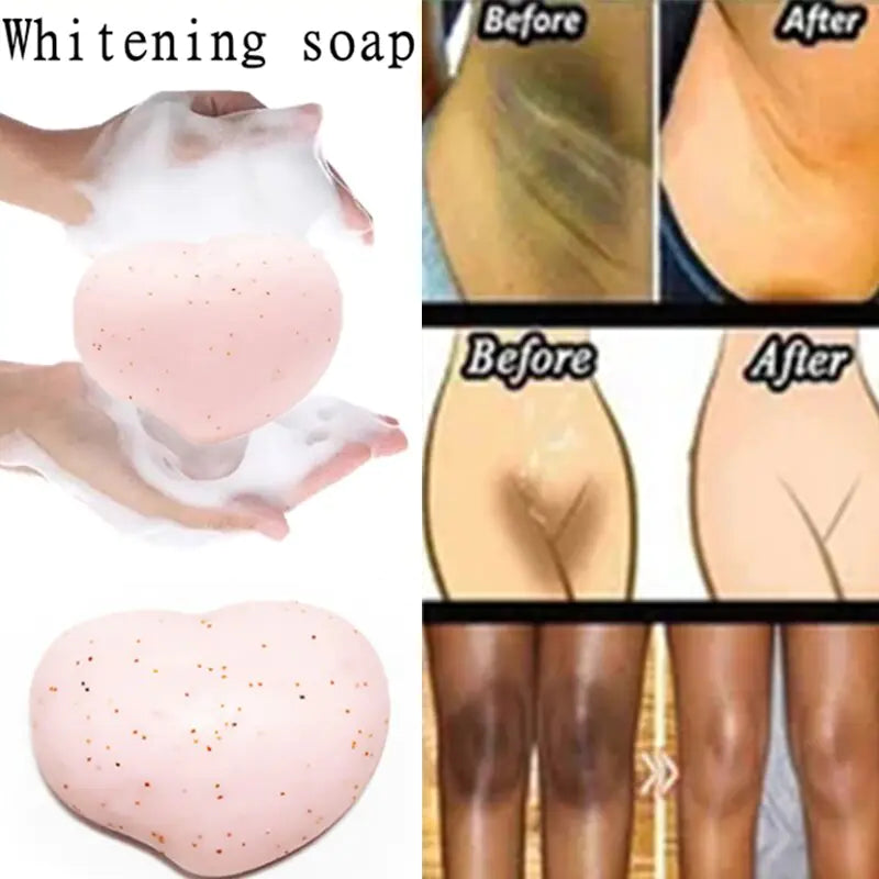 Whitening Soap: Body Care Solution